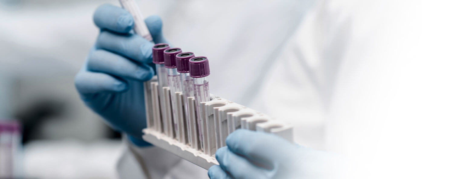 Laboratory Testing Image